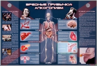 Электрифицированный стенд "Вредные привычки: алкоголизм" - «globural.ru» - Воронеж
