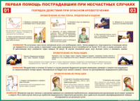 Таблица Порядок действий при опасном кровотечении 1000*1400 винил - «globural.ru» - Воронеж